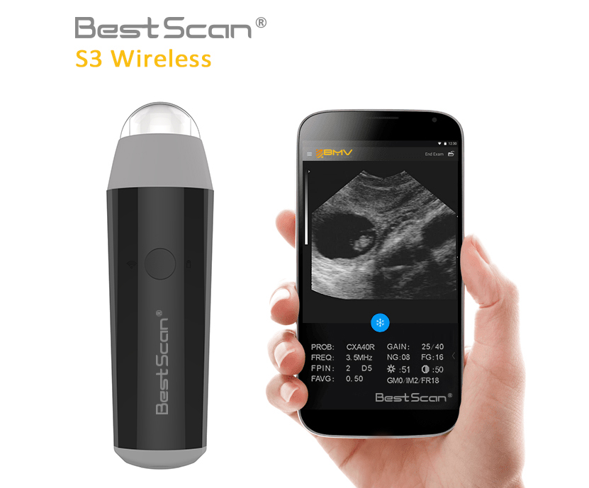 BestScan S3 Wireless